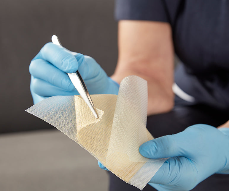 Manuka honey dressings for wounds