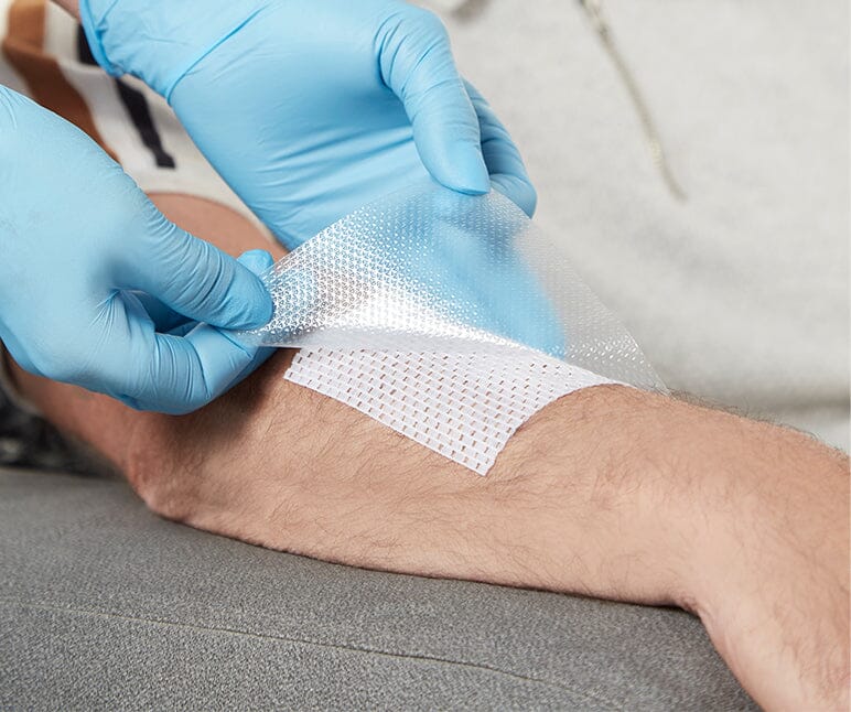 Skin tear prevention